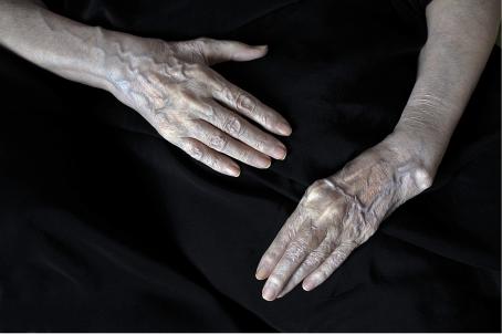 Mustaa taustaa vasten ihmisen kädet. Verisuonet erottuvat selkeästi ja kädet näyttävät vanhoilta. 