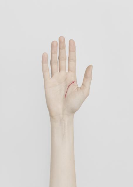 Valkoista taustaa vasten ihmisen käsi kämmenpuoli ylöspäin. Kämmenen oikeassa reunassa on punainen haava, joka seuraa kämmenen viivaa.